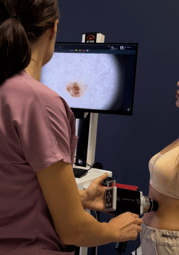 FotoFinder ATBM Master