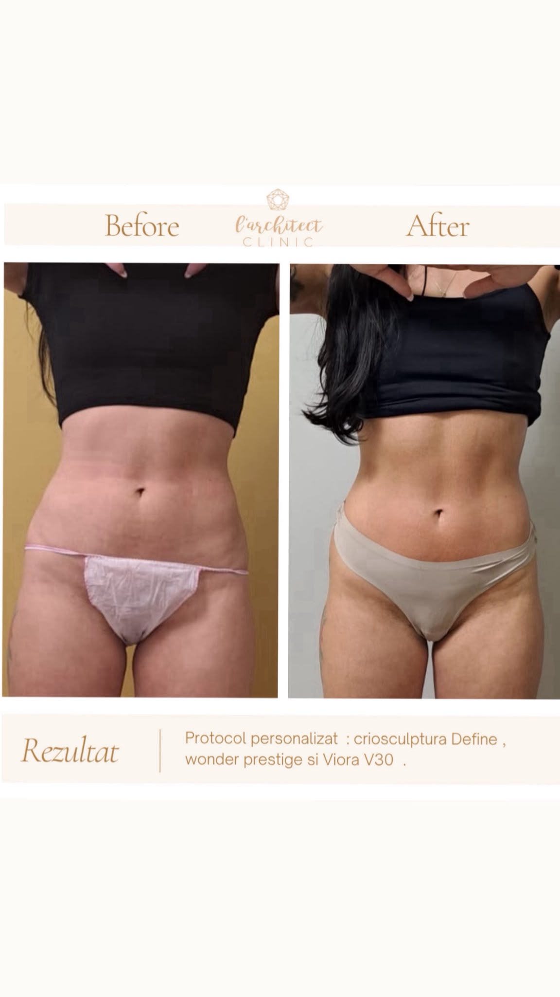 Criosculptură Define + Wonder + Viora