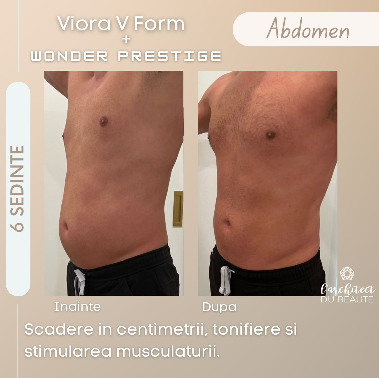 Viora V-Form + Wonder — tonifiere