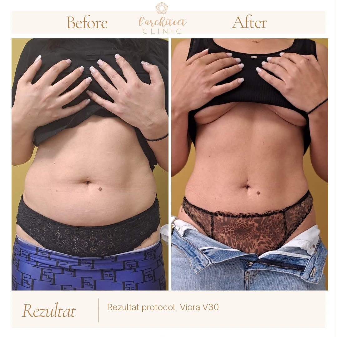 Viora V30 — remodelare