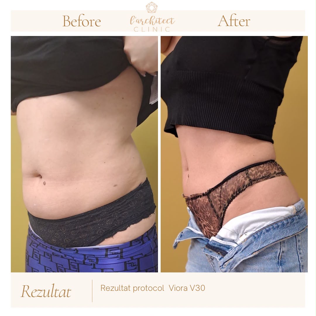 Viora V30 — remodelare