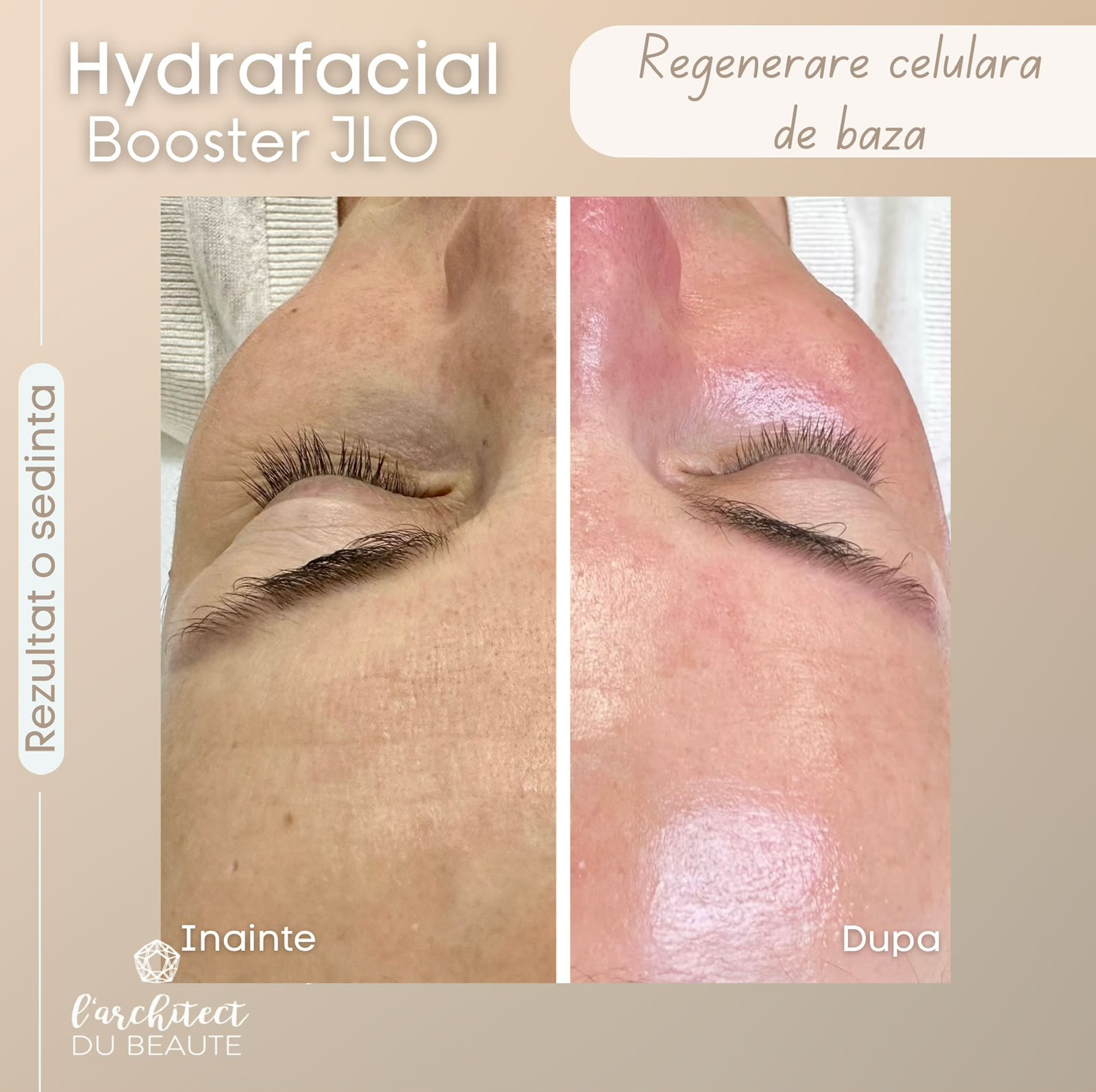 HydraFacial Booster JLO